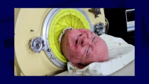 États-Unis: l'homme qui vivait dans un "poumon de fer" à cause de la polio depuis 72 ans est mort