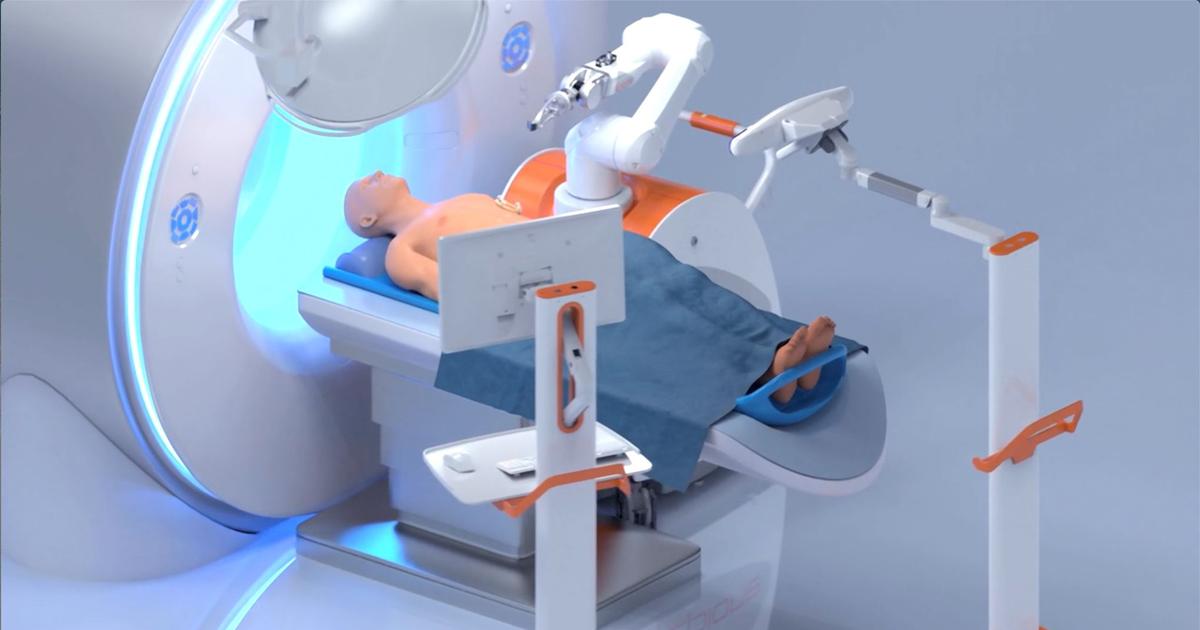 Un robot français pour neutraliser le cancer